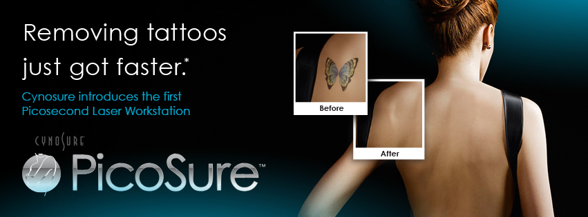 Laser Tattoo Removal | Chattanooga, TN | Shire Facial ...